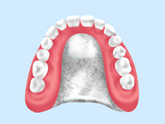 自費の入れ歯