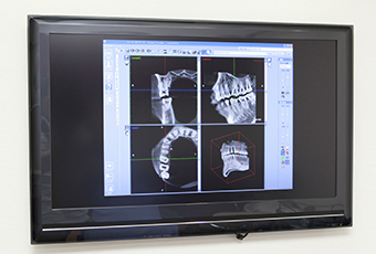 ～精密な治療のために歯科用CTを使用します～