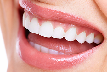 歯の黄ばみはホワイトニングで白くできます